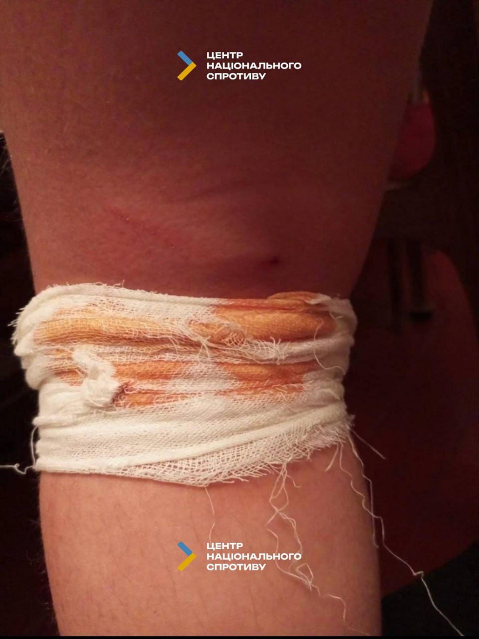 На окупованій Луганщині зростає кількість нападів зграї диких собак